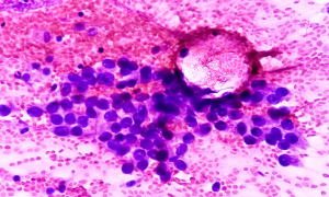 Cytology