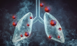 Human Diseases